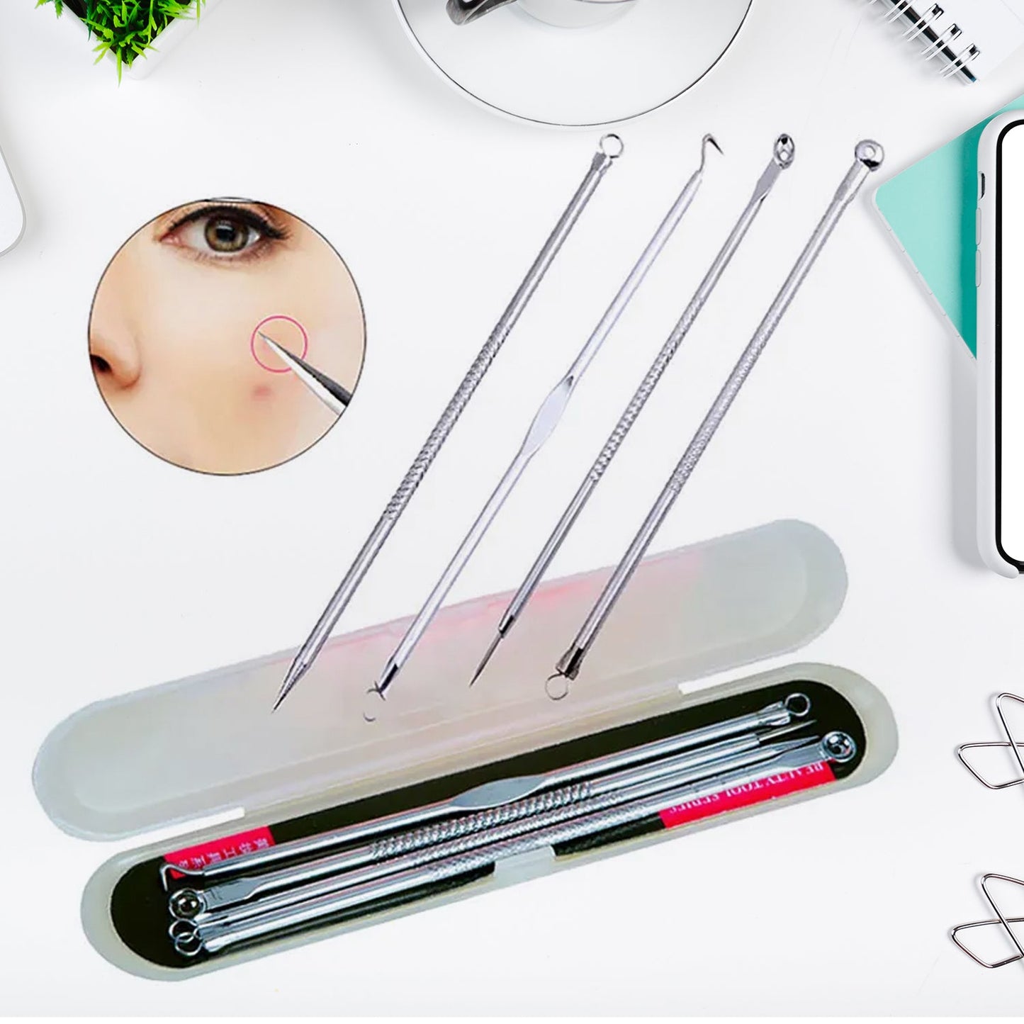 Blackhead Remover, 4-in-1 Stainless Steel Pimple Extractor Tool (1 Pc) SWASTIK CREATIONS The Trend Point