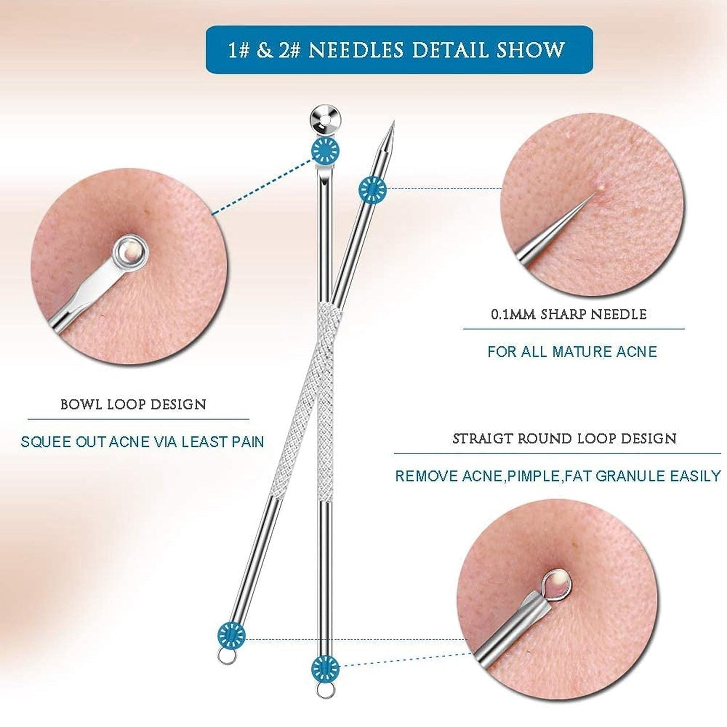 Blackhead Remover, 4-in-1 Stainless Steel Pimple Extractor Tool (1 Pc) SWASTIK CREATIONS The Trend Point