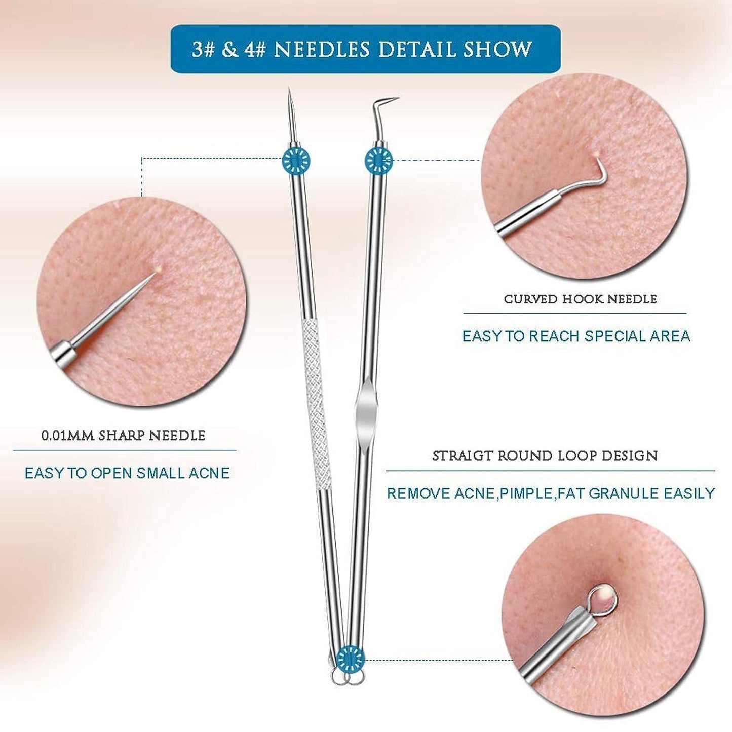 Blackhead Remover, 4-in-1 Stainless Steel Pimple Extractor Tool (1 Pc) SWASTIK CREATIONS The Trend Point